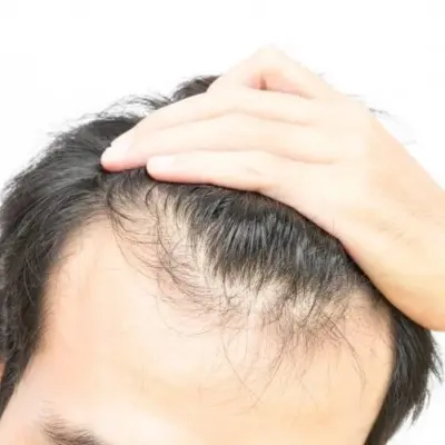 پودر ضد ریزش مو